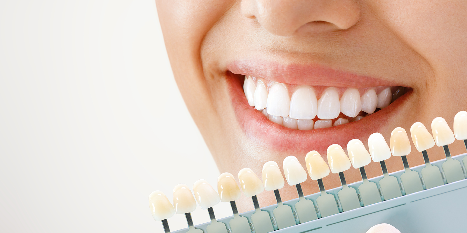 ホワイトニングについて